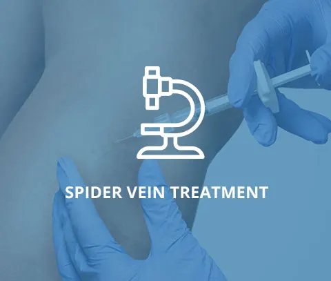 Medical professional performing spider vein treatment with syringe and microscope overlay.