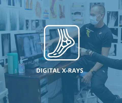 Medical professionals analyzing digital foot X-rays on a computer screen in a clinic setting.